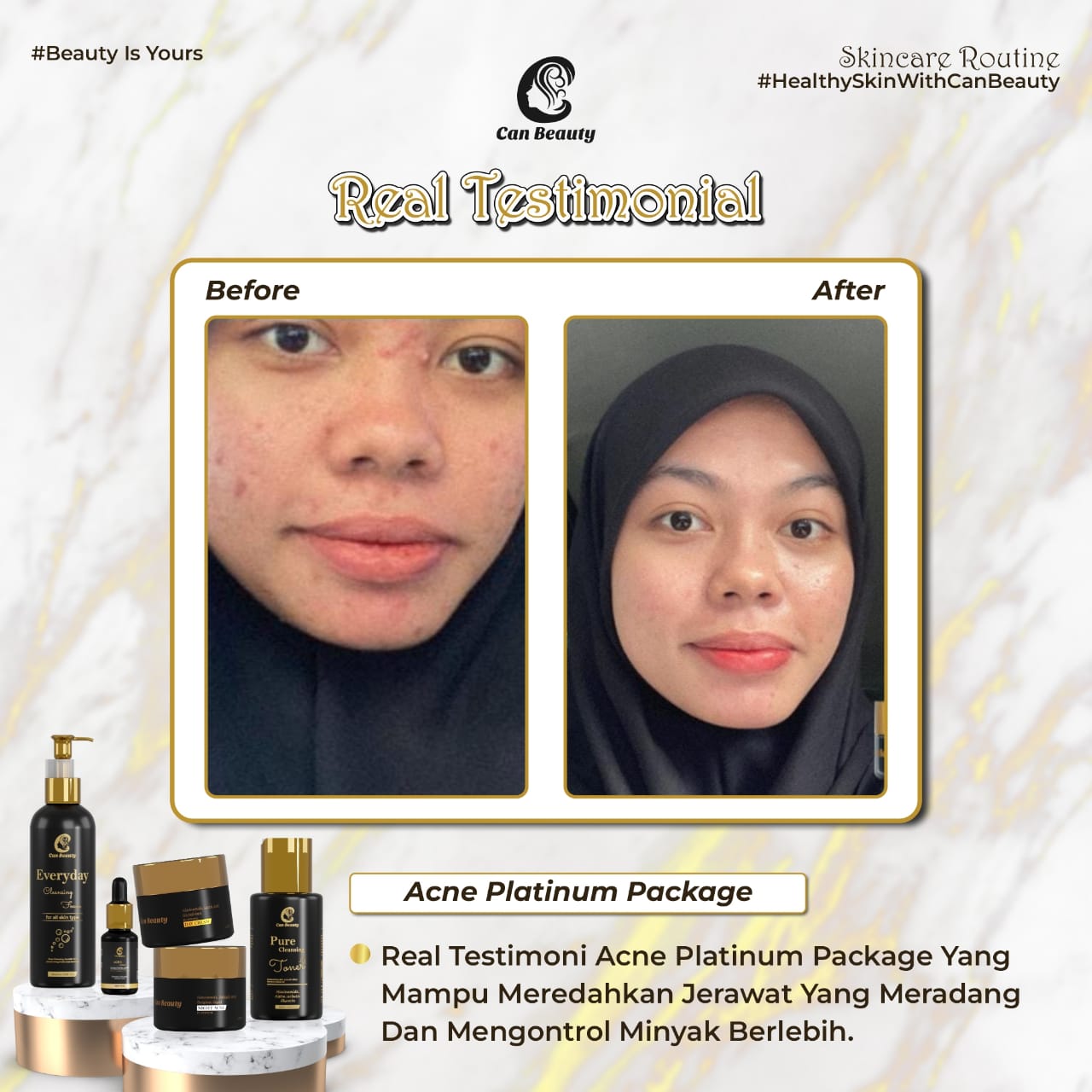 testimoni can beauty